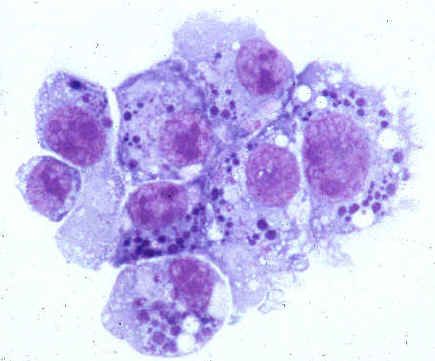 Patogény ľudskej anaplazmózy (rod Anaplasmataceae)