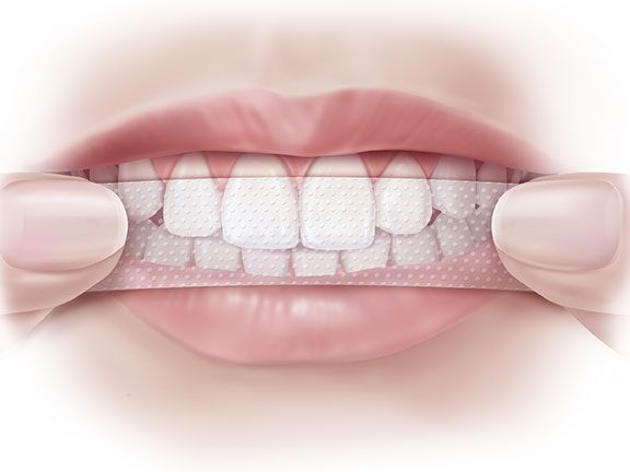 Ako používať bieliace pásy na zuby?