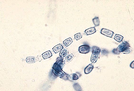 Parakokcidia je pôvodcom parakokcidioidózy