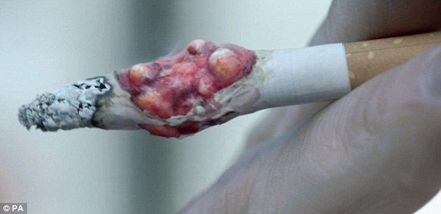 V Spojenom kráľovstve začali hrozné anti-reklamné cigarety