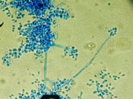 Príčinný faktor favus (Trichophyton schoenleinii)
